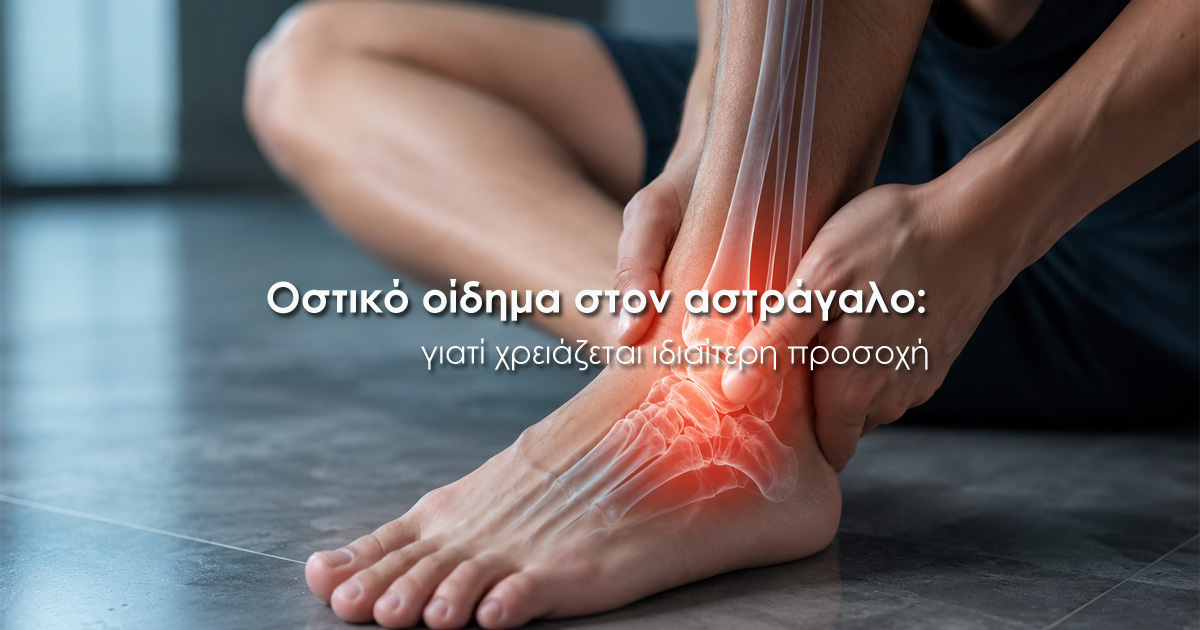 Οστικό οίδημα στον αστράγαλο: