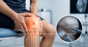 Πόνος στο γόνατο Πότε χρειάζεται αρθροσκόπηση και τι πρέπει να γνωρίζετε