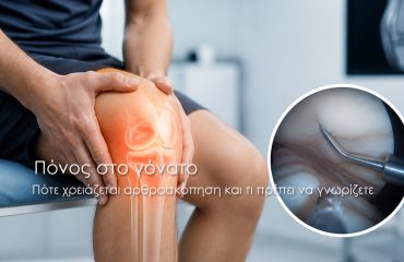 Πόνος στο γόνατο Πότε χρειάζεται αρθροσκόπηση και τι πρέπει να γνωρίζετε