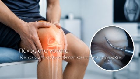 Πόνος στο γόνατο Πότε χρειάζεται αρθροσκόπηση και τι πρέπει να γνωρίζετε