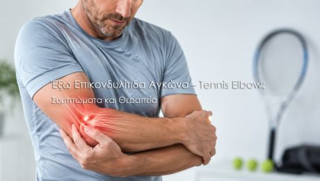 Έξω Επικονδυλίτιδα Αγκώνα – Tennis Elbow: Συμπτώματα και Θεραπεία