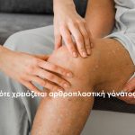αρθροπλαστική γόνατος σε ασθενή